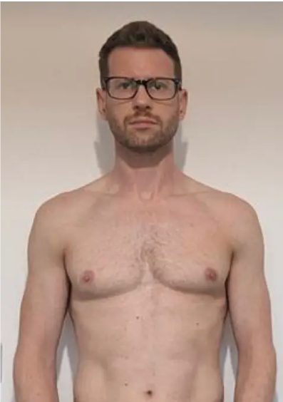 Client before training