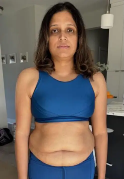 Client before training